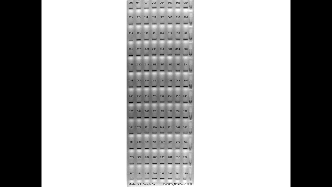 Fig. 3 Analysis of PCR products using agarose gel.