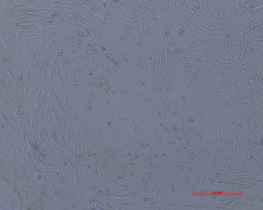 human ovarian cancer cell