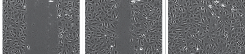Typical images of wound healing assay